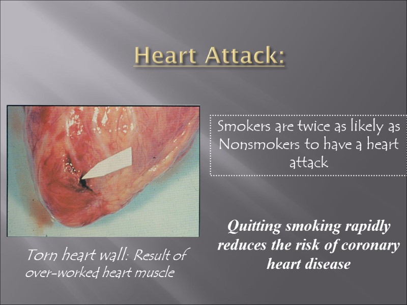 Heart Attack:   Quitting smoking rapidly reduces the risk of coronary heart disease